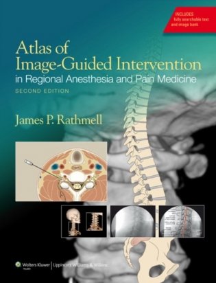 Atlas of Image-Guided Intervention in Pain Medicine, 2e фото книги
