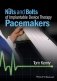 The Nuts and Bolts of Implantable Device Therapy: Pacemakers фото книги маленькое 2