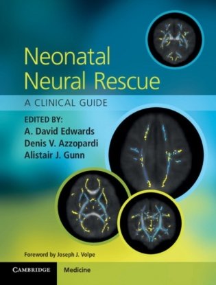Neonatal Neural Rescue фото книги