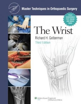 Mtos: the wrist, 3e фото книги