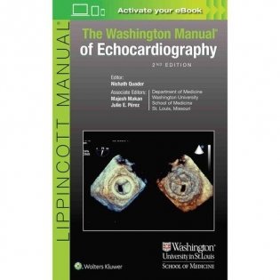 The Washington Manual of Echocardiography фото книги