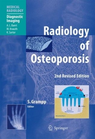 Radiology of Osteoporosis фото книги
