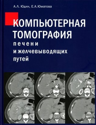 Компьютерная томография печени и желчевыводящих путей: практическое руководство фото книги