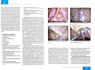 Лапароскопические и ретроперитонеоскопические операции в урологии фото книги 2