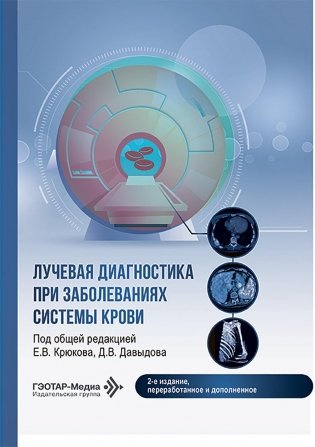 Лучевая диагностика при заболеваниях системы крови . 2-е изд., перераб. и доп фото книги