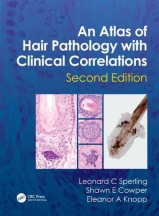 An Atlas of Hair Pathology with Clinical Correlations, 2 Ed. фото книги