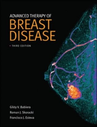 Advanced therapy of breast disease фото книги