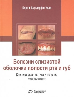 Болезни слизистой оболочки полости рта и губ. Клиника, диагностика и лечение. Атлас и руководство фото книги