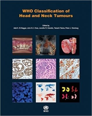 WHO Classification of Head and Neck Tumours 4 ed. фото книги