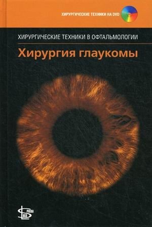 Хирургия глаукомы (+ DVD) фото книги