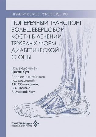 Поперечный транспорт большеберцовой кости в лечении тяжелых форм диабетической стопы. Практическое руководство фото книги