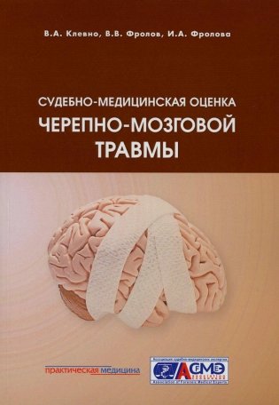 Судебно-медицинская оценка черепно-мозговой травмы: Учебное пособие фото книги