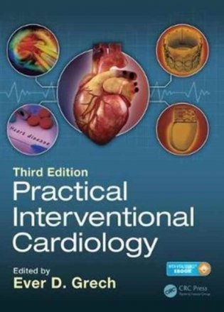 Practical Interventional Cardiology фото книги