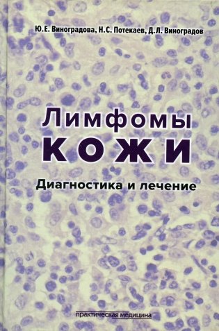 Лимфомы кожи: Диагностика и лечение фото книги