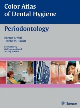Color Atlas of Dental Hygiene: Periodontology фото книги