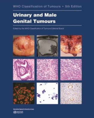 Who Classification of Tumour: Urinary and Male Genital Tumours 8 Vol. фото книги