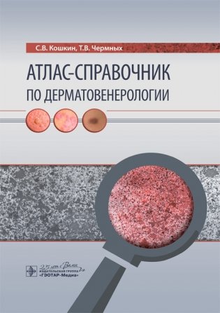 Атлас-справочник по дерматовенерологии фото книги