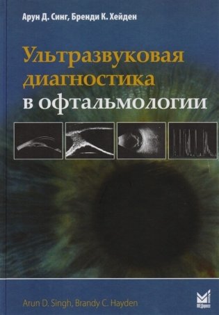 Ультразвуковая диагностика в офтальмологии фото книги