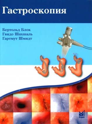 Гастроскопия. 5-е изд фото книги