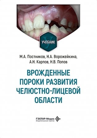Врожденные пороки развития челюстно-лицевой области: Учебник фото книги