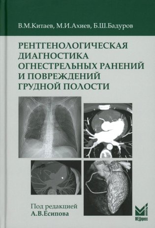Рентгенологическая диагностика огнестрельных ранений и повреждений грудной полости фото книги