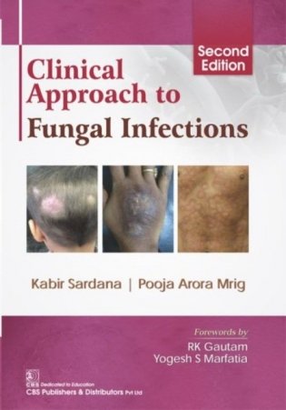 Clinical Approach To Fungal Infections 2Ed (Hb 2019) фото книги