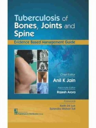 Tuberculosis Of Bones Joints And Spine (Hb 2017) фото книги
