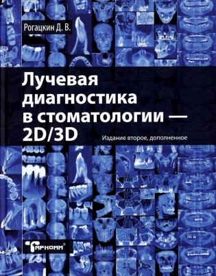 Лучевая диагностика в стоматологии: 2D/3D. 2-е изд., доп фото книги