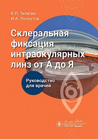 Склеральная фиксация интраокулярных линз от А до Я : руководство для врачей фото книги