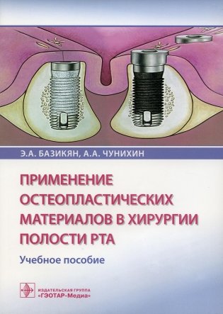 Применение остеопластических материалов в хирургии полости рта. Учебное пособие фото книги