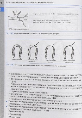 Справочник по эхокардиографии фото книги 11