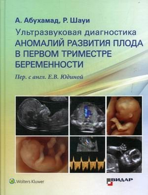 Ультразвуковая диагностика аномалий развития плода в первом триместре беременности. Руководство фото книги