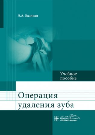 Операция удаления зуба фото книги