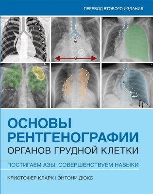 Основы рентгенографии органов грудной клетки фото книги