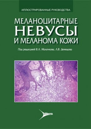 Меланоцитарные невусы и меланома кожи фото книги