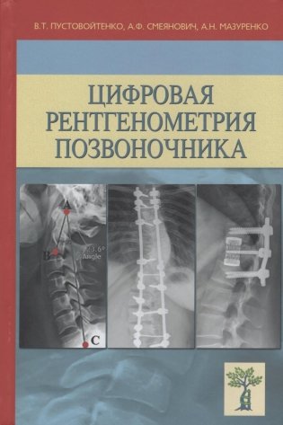 Цифровая рентгенометрия позвоночника фото книги