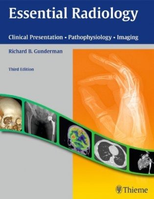 Essential Radiology: Clinical Presentation. Pathophysiology. Imaging фото книги