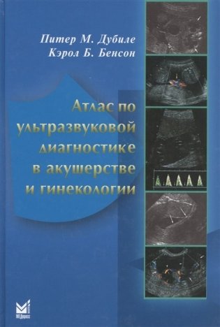 Атлас по ультразвуковой диагностике в акушерстве и гинекологии фото книги