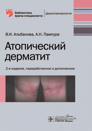 Атопический дерматит фото книги