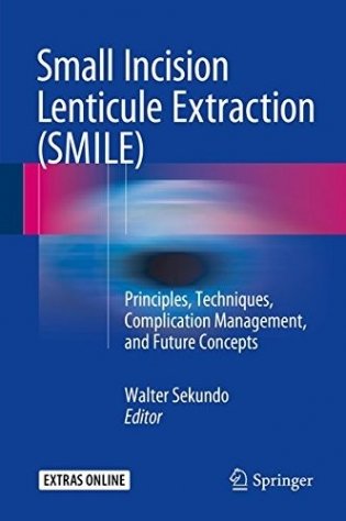 Small Incision Lenticule Extraction (SMILE) фото книги