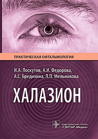 Халазион фото книги