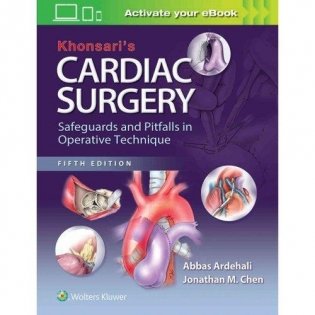 Khonsari's Cardiac Surgery: Safeguards and Pitfalls in Operative Technique фото книги
