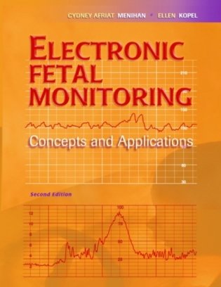 Electronic Fetal Monitoring фото книги