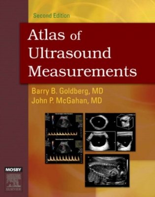 Atlas of Ultrasound Measurements фото книги