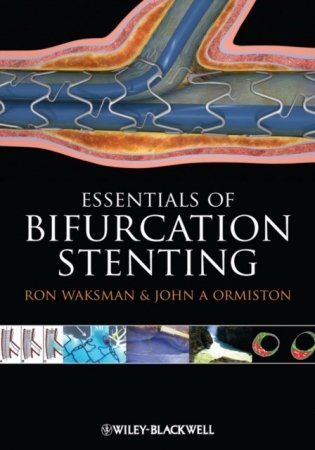 Essentials of Bifurcation Stenting фото книги