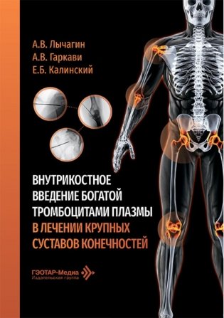 Внутрикостное введение богатой тромбоцитами плазмы в лечении крупных суставов конечностей фото книги