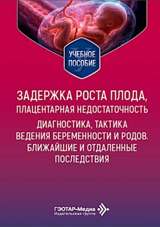 Задержка роста плода, плацентарная недостаточность. Диагностика, тактика ведения беременности и родов. Ближайшие и отдаленные последствия фото книги