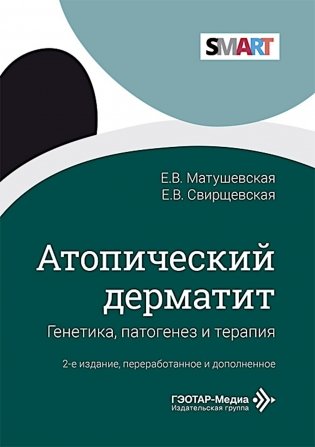 Атопический дерматит. Генетика, патогенез и терапия. 2-е изд., перераб. и доп фото книги