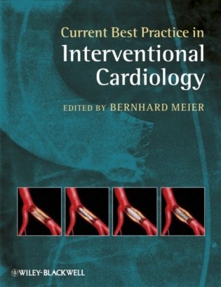 Current Best Practice in Interventional Cardiology фото книги