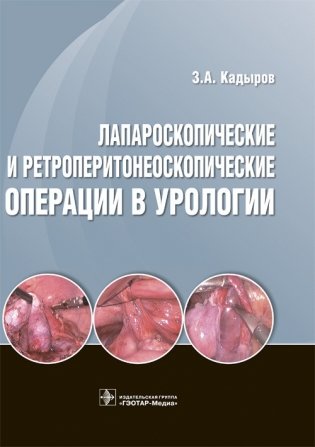 Лапароскопические и ретроперитонеоскопические операции в урологии фото книги